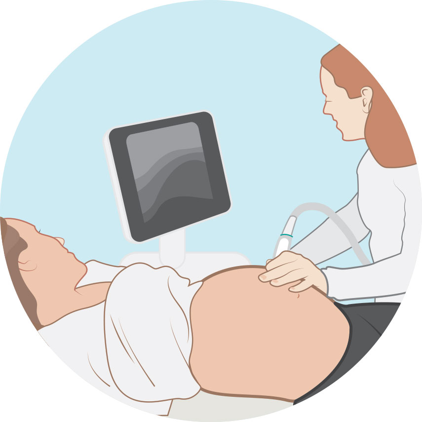 Prenatale-testen-2 echo.jpg
