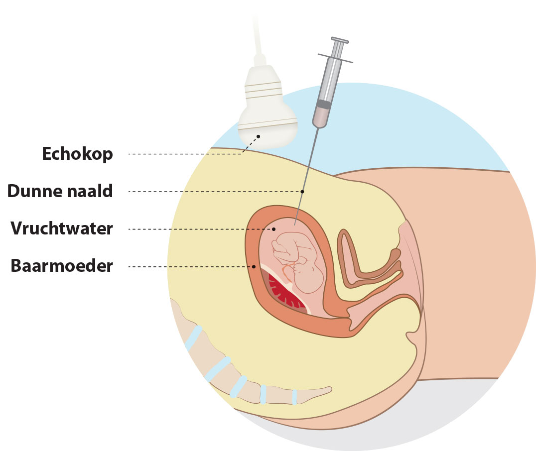 Prenatale-vervolgonderzoeken-3.jpg